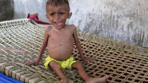 الفاو تشدد على أهمية تضافر الجهود الدولية لتجنب خطر المجاعة في اليمن