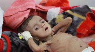الأغذية العالمي يحذر من الدفع بمليون يمني إلى حافة المجاعة بسبب الحرب