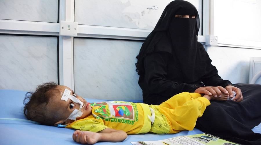 مسؤول أممي: المجاعة تهدد أطفال اليمن وهم في أحضان أمهاتهم العاجزات
