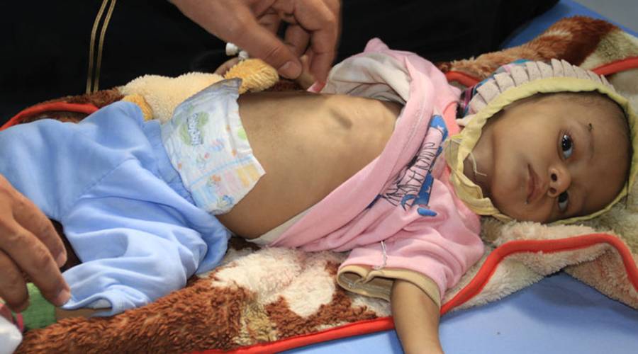 برنامج الأغذية العالمي: 8 ملايين يمني يعانون من جوع شديد