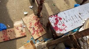 ضحايا مدنيين إثر انفجار عبوة ناسفة في شارع جمال بتعز