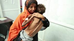 الأمم المتحدة: المجاعة في اليمن أسوأ كوارث العصر الحديث