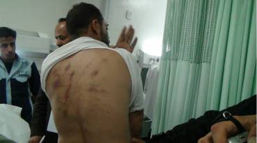 تحالف رصد يكشف عن 455 حالة تعذيب ارتكبتها مليشيا الحوثي