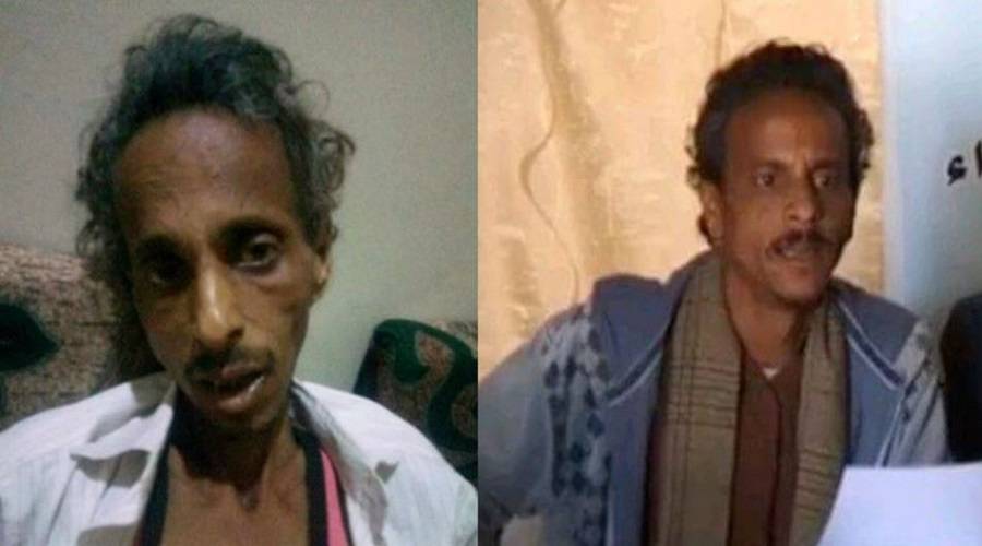 مليشيا الحوثي تعذب الصحفي أنور الركن حتى الموت