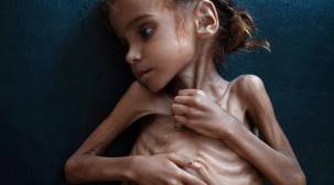 مجلة أمريكية: ترامب متواطئ مع السعودية في تجويع اليمن