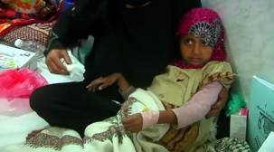 وباء الكوليرا يجتاح المدن اليمنية 
