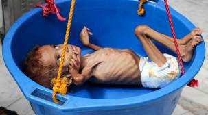 الأمم المتحدة تحذر من مجاعة واسعة يصعب السيطرة عليها في اليمن
