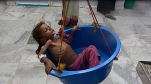 المجاعة تهدّد مليون طفل إضافي بسبب  المعارك في الحديدة