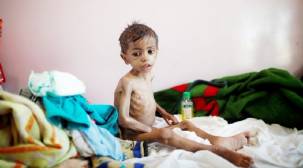 يونيسيف: كل 10 دقائق يموت طفل يمني بسبب أوبئة يمكن علاجها