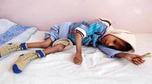 البنك الدولي ومنظمة الأغذية يطلقان برنامجا للحد من المجاعة في اليمن