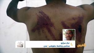 متى يتوقف التعذيب في عدن؟ | تقديم: عبد الله الحرزاي