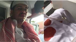 فيديو لمغترب يمني يقول أنه تعرض لاعتداء من قبل أحد &quot;الأمراء السعوديين&quot;