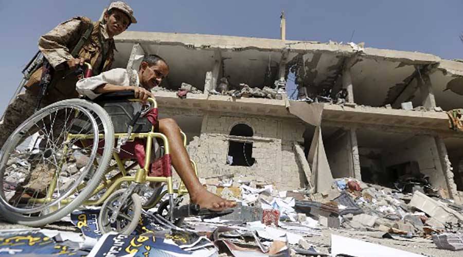 قصص مأساوية يعيشها معاقو الحرب في اليمن