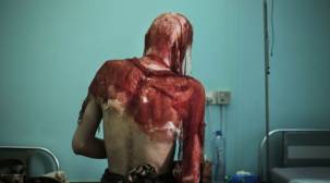 أسوشييتد برس تكشف عن حالات تعذيب وحشية للمعتقلين في سجون الحوثيين
