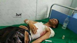 إصابة الناشط إبراهيم الجبري برصاص مسلح يستقل دراجة نارية بتعز