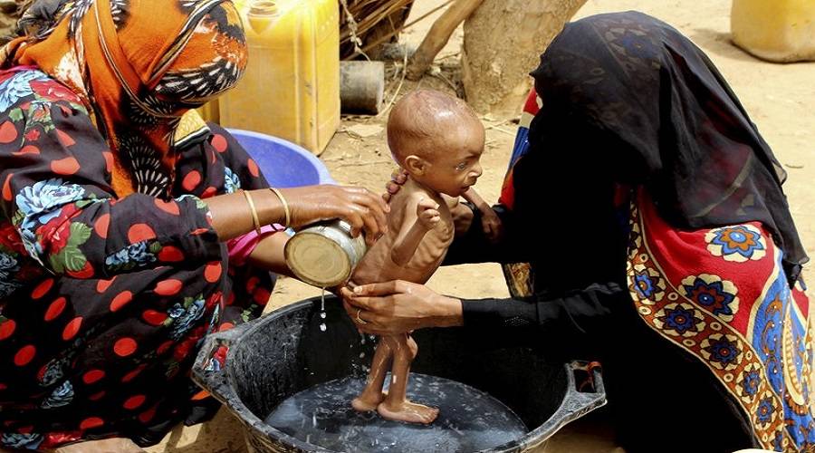 يمنيون يأكلون أوراق الشجر حتى أصبحت عظامهم ظاهرة &quot;فيديو&quot;