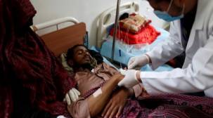  الكوليرا تقتل 25 شخصا خلال أسبوع في اليمن